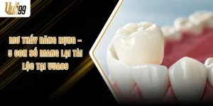 Mơ Thấy Răng Rụng - 5 Con Số Mang Lại Tài Lộc Tại VUA99